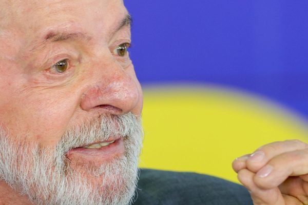 Lula tem evolução satisfatória após cirurgia de catarata